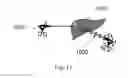 Fig. 17 - Device and method for assisting laparoscopic surgery—rule based approach