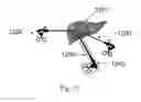 Fig. 20 - Device and method for assisting laparoscopic surgery—rule based approach