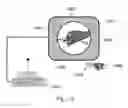 Fig. 22 - Device and method for assisting laparoscopic surgery—rule based approach