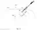 Fig. 25 - Device and method for assisting laparoscopic surgery—rule based approach