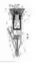 Fig. 08 - Low-cost instrument for endoscopically guided operative procedures