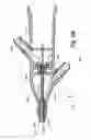 Fig. 09 - Low-cost instrument for endoscopically guided operative procedures