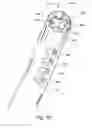 Fig. 12 - Low-cost instrument for endoscopically guided operative procedures