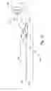 Fig. 15 - Low-cost instrument for endoscopically guided operative procedures