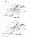 Fig. 17 - Low-cost instrument for endoscopically guided operative procedures