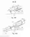 Fig. 19 - Low-cost instrument for endoscopically guided operative procedures