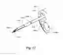 Fig. 20 - Low-cost instrument for endoscopically guided operative procedures