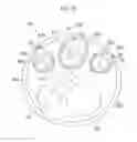 Fig. 11 - Endoscope