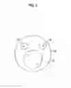 Fig. 03 - Endoscopic surgical device, overtube, and endoscope