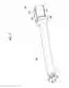 Fig. 16 - Endoscopic surgical device, overtube, and endoscope