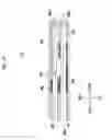 Fig. 13 - Endoscopic surgical device and overtube