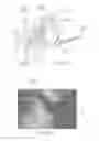 Fig. 17 - Systems and methods for optimizing and maintaining visualization of a surgical field during the use of surgical scopes