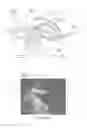 Fig. 19 - Systems and methods for optimizing and maintaining visualization of a surgical field during the use of surgical scopes