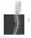 Fig. 08 - Method and system for evaluating progression of age-related macular degeneration