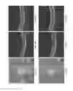 Fig. 09 - Method and system for evaluating progression of age-related macular degeneration