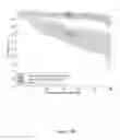 Fig. 16 - Method and system for evaluating progression of age-related macular degeneration