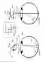 Fig. 09 - Head-mounted optical coherence tomography