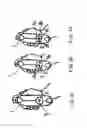 Fig. 04 - Optometric instrument with alignment means and method for aligning an optometric instrument