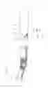 Fig. 10 - DENTAL TREATMENT IMPLEMENT WITH ANOMALY SITE DETECTION FUNCTION