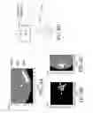 Fig. 09 - Photoacoustic information acquiring apparatus and processing method