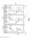 Fig. 06 - SEM scanner sensing apparatus, system and methodology for early detection of ulcers