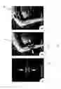 Fig. 08 - Apparatus and method for measuring an anatomical angle of a body