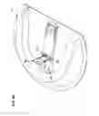 Fig. 10 - ON-BODY MEDICAL DEVICE SECUREMENT