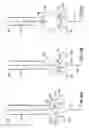 Fig. 07 - Needle protective device for subcutaneous sensors