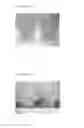 Fig. 04 - MICRO-NEEDLE AND SENSOR FOR DETECTING NITROGEN MONOOXIDE COMPRISING THE SAME