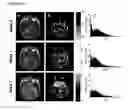 Fig. 03 - SYSTEMS AND METHODS FOR IMAGING CHANGES IN TISSUE