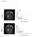 Fig. 04 - SYSTEMS AND METHODS FOR IMAGING CHANGES IN TISSUE