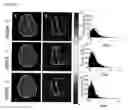 Fig. 05 - SYSTEMS AND METHODS FOR IMAGING CHANGES IN TISSUE