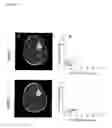Fig. 06 - SYSTEMS AND METHODS FOR IMAGING CHANGES IN TISSUE