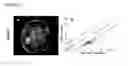 Fig. 08 - SYSTEMS AND METHODS FOR IMAGING CHANGES IN TISSUE