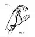 Fig. 03 - Sensor Embedded Wearable Technology Glove