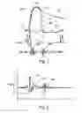 Fig. 02 - Implantable medical device with active detection of atrial mechanical activity
