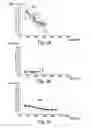 Fig. 03 - Implantable medical device with active detection of atrial mechanical activity