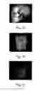 Fig. 05 - Dental imaging apparatus