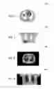 Fig. 04 - System and method for joint estimation of attenuation and activity information