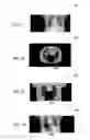 Fig. 05 - System and method for joint estimation of attenuation and activity information