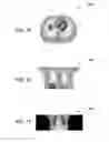 Fig. 07 - System and method for joint estimation of attenuation and activity information