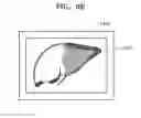 Fig. 14 - Method and apparatus for generating body marker