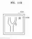 Fig. 17 - Method and apparatus for generating body marker