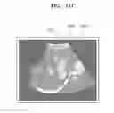 Fig. 18 - Method and apparatus for generating body marker