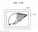 Fig. 19 - Method and apparatus for generating body marker