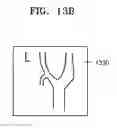 Fig. 22 - Method and apparatus for generating body marker