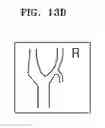 Fig. 24 - Method and apparatus for generating body marker