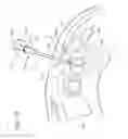 Fig. 13 - FINE NEEDLE BIOPSY WITH ADAPTOR