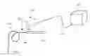 Fig. 01 - USE OF LASER FOR EUS FNA TISSUE ACQUISITION