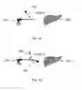 Fig. 07 - Device and method for assisting laparoscopic surgery rule based approach